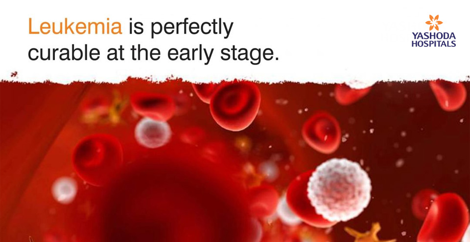 Leukemia is perfectly curable at the early stage