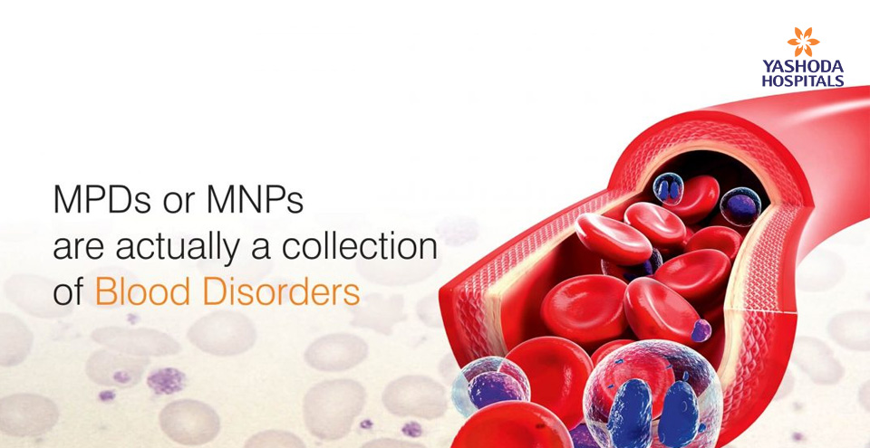 Myeloproliferative disorders (MPD)