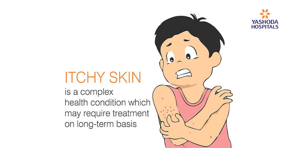 Itchy Skin