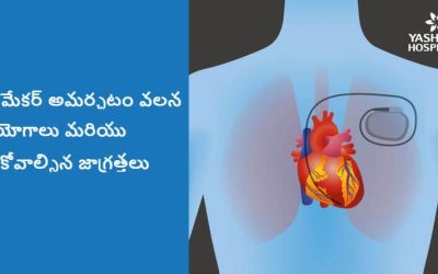 మీ గుండె స్పందనలు నెమ్మదిస్తే పేస్ మేకర్ గుండె స్పందనలను ఆరోగ్యకరస్థాయిలో ఉండేట్లు నియత్రిస్తుంటుంది