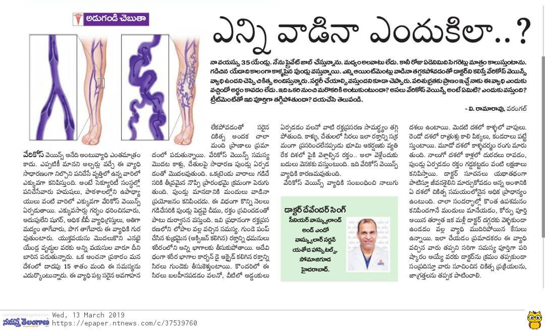 Treatment-for-Vericose-veins-Dr-Devender-Singh