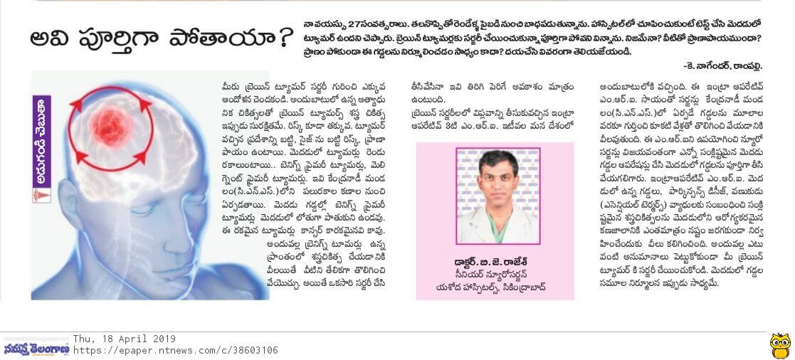 Brain tumor treatment - Dr BJ Rajesh Neurosurgeon