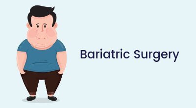 bariatric surgery Infographics