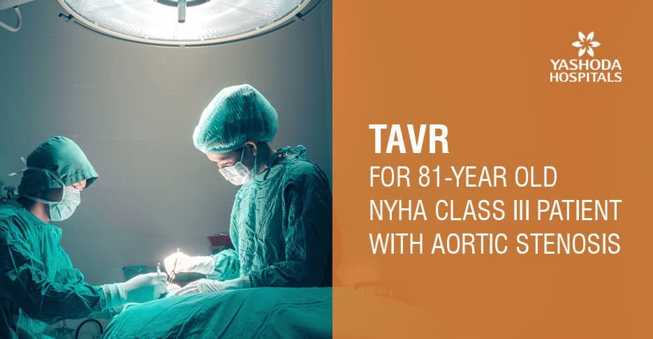 TAVR for 81-year old NYHA class III patient with aortic stenosis