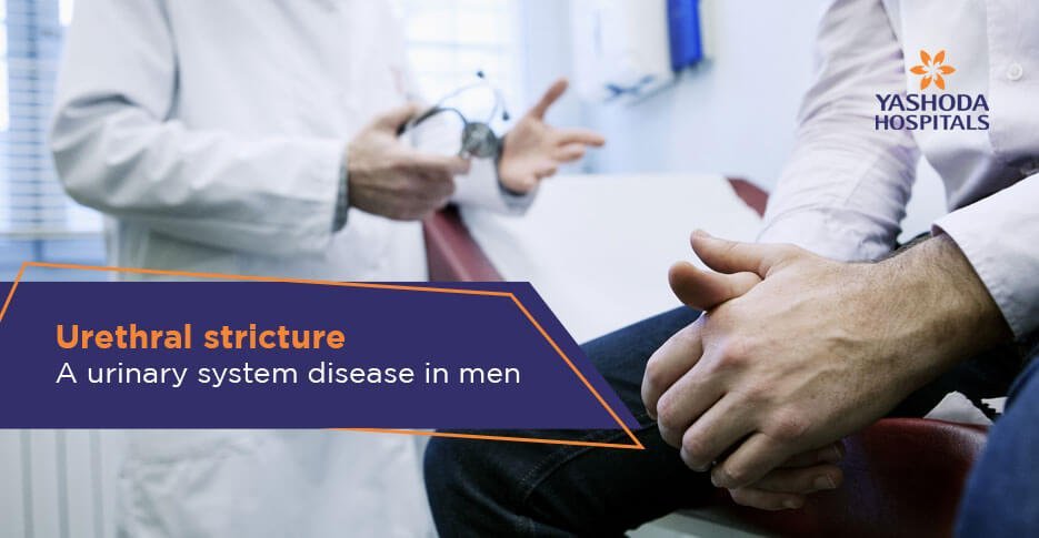 Male urethral stricture – The disease is as old as humanity