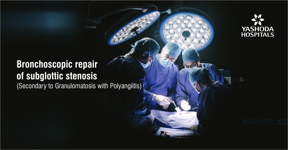 Bronchoscopic repair of subglottic stenosis (secondary to granulomatosis with polyangiitis)