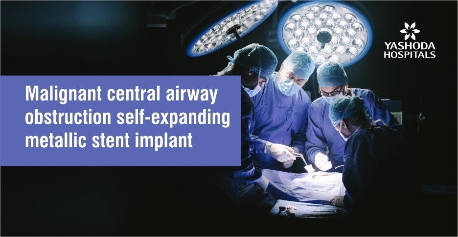 Malignant central airway obstruction self-expanding metallic stent implant
