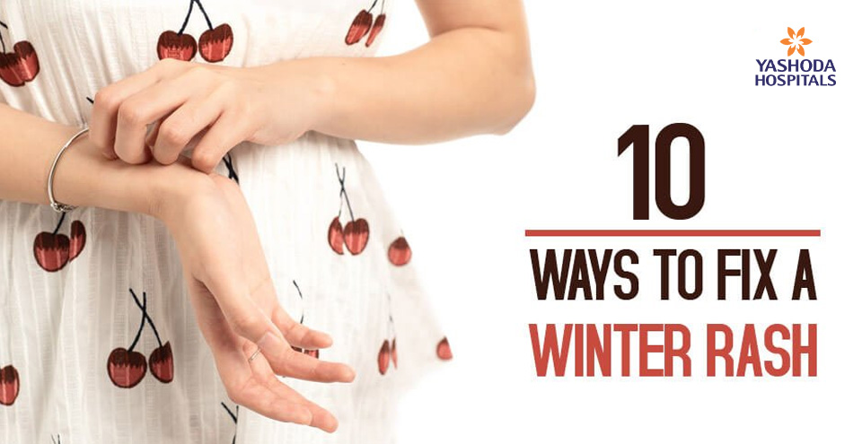 How to Fix a Winter Rash?