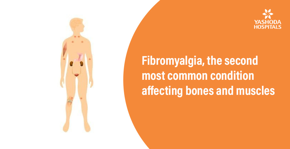 Fibromyalgia, the second most common condition affecting bones and muscles