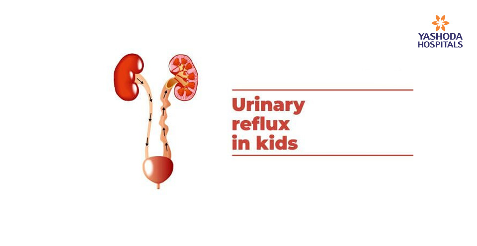 Vesicoureteral Reflux (VUR) correction in children