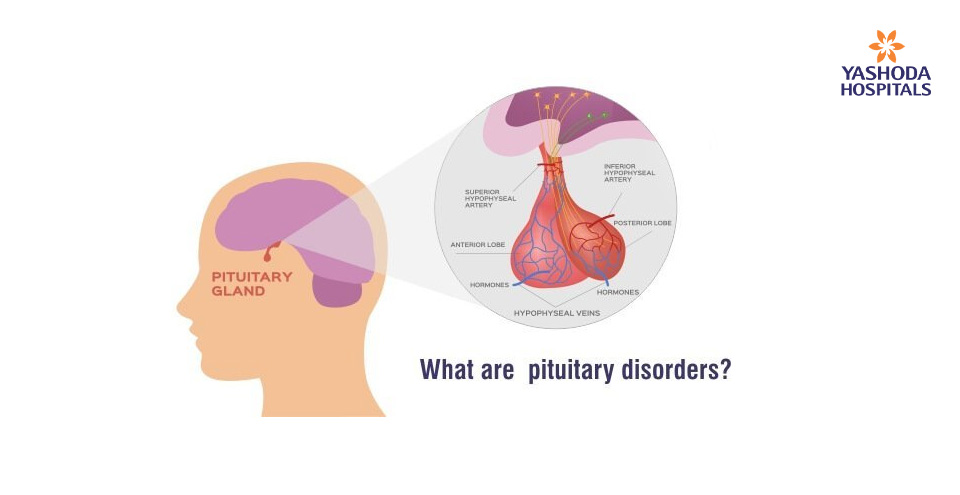 How to diagnose and cope with the side-effects of treatment for pituitary tumours?