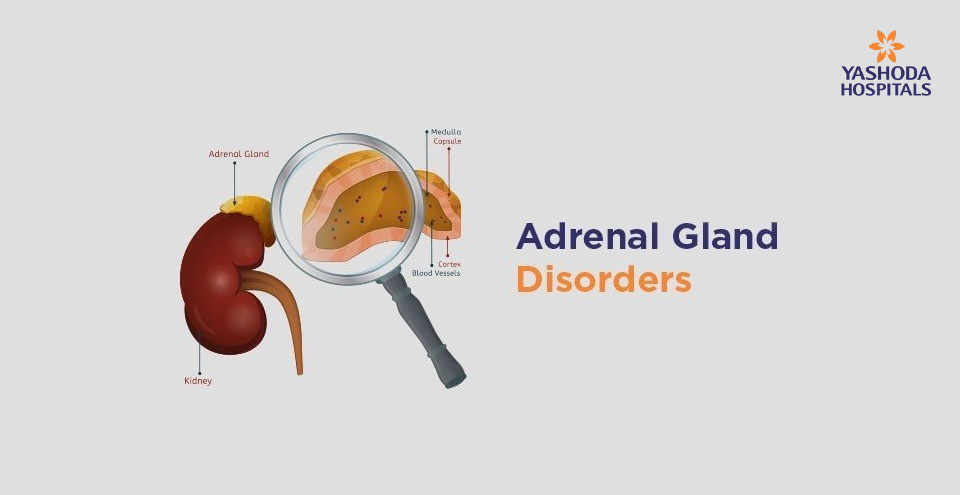 How to diagnose and treat Adrenal Gland Disorders? How to stage Adrenal cancer?