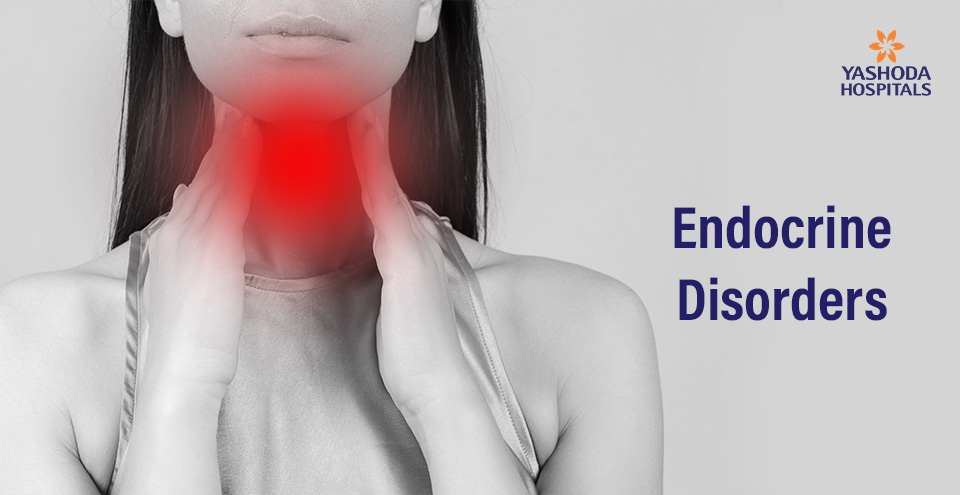 How to diagnose and treat Endocrine disorders?