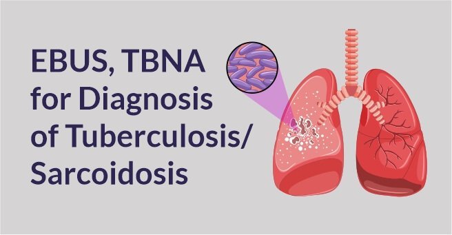 EBUS-TBNA for Diagnosis of Tuberculosis / Sarcoidosis