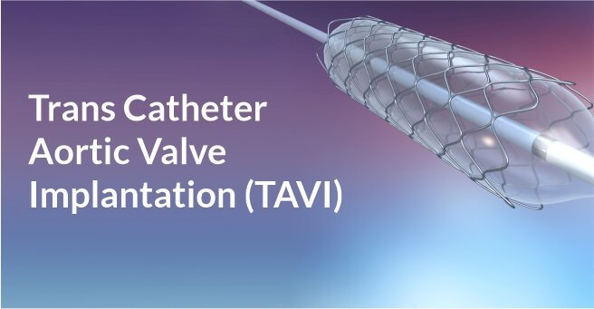 Trans Catheter Aortic Valve Implantation (TAVI) – Case-2