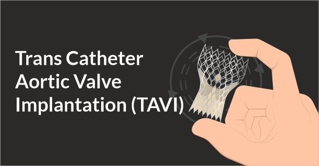 Trans Catheter Aortic Valve Implantation (TAVI) – Case-3
