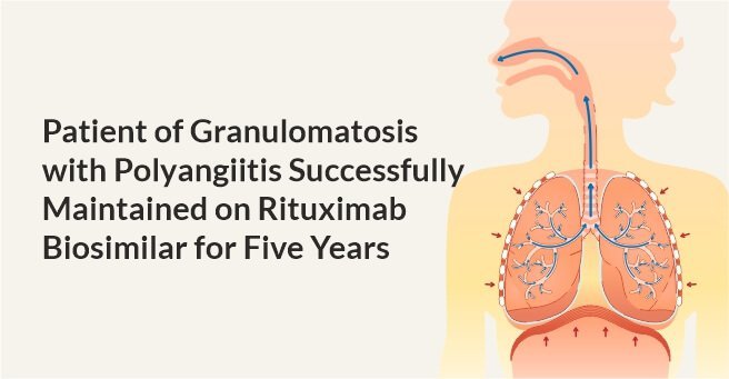 Granulomatosis with Polyangiitis Successfully Maintained on Rituximab Biosimilar for Five Years