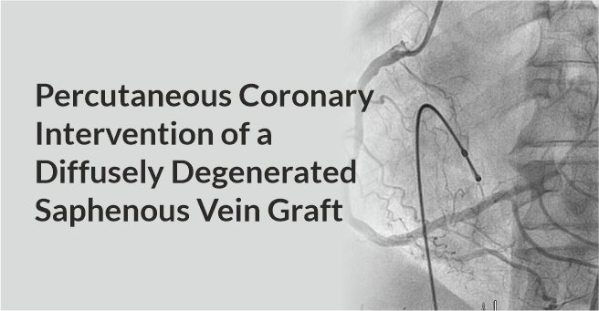 Percutaneous Coronary Intervention of A Diffusely Degenerated Saphenous Vein Graft: A Road Less Taken