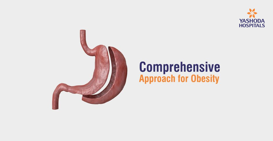 Comprehensive Approach for Obesity