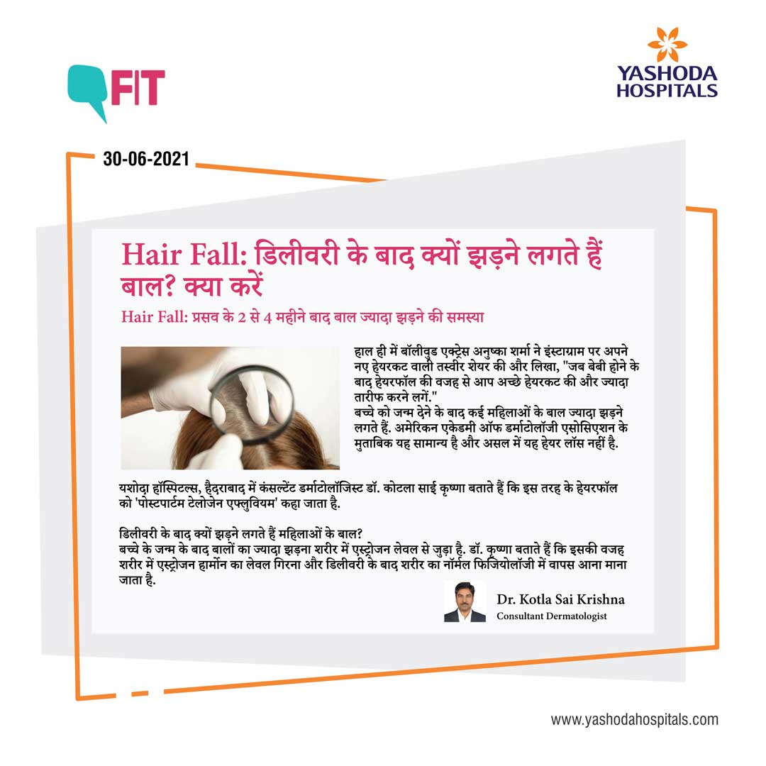 All about hair-fall