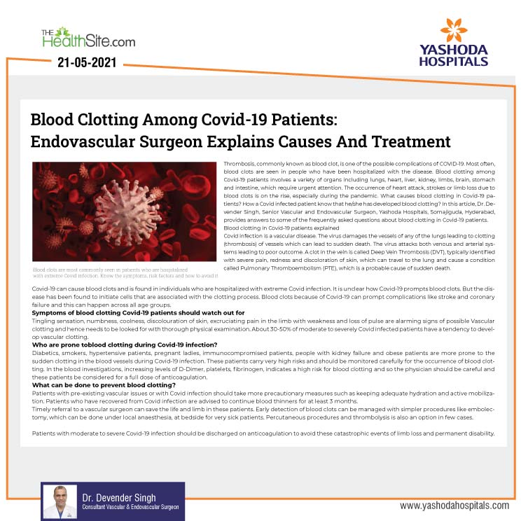Blood clotting in Covid patients, causes and treatment