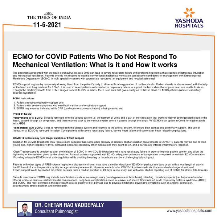 ECMO for Covid-19 patients