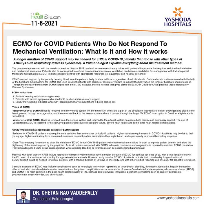 What is the role of ECMO in Covid patients?