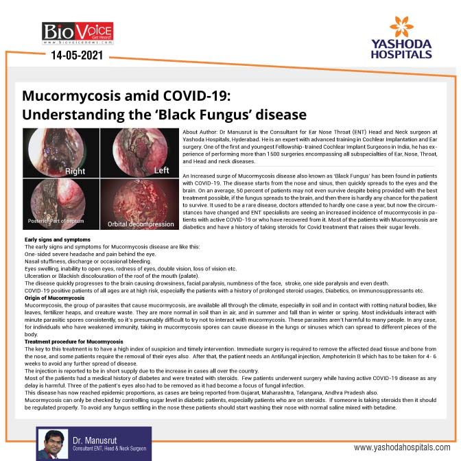 Mucormycosis amid Covid-19