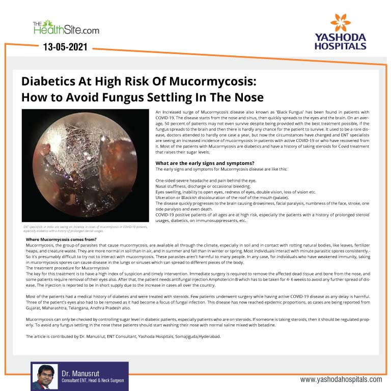 Diabetics are at high risk of Mucormycosis