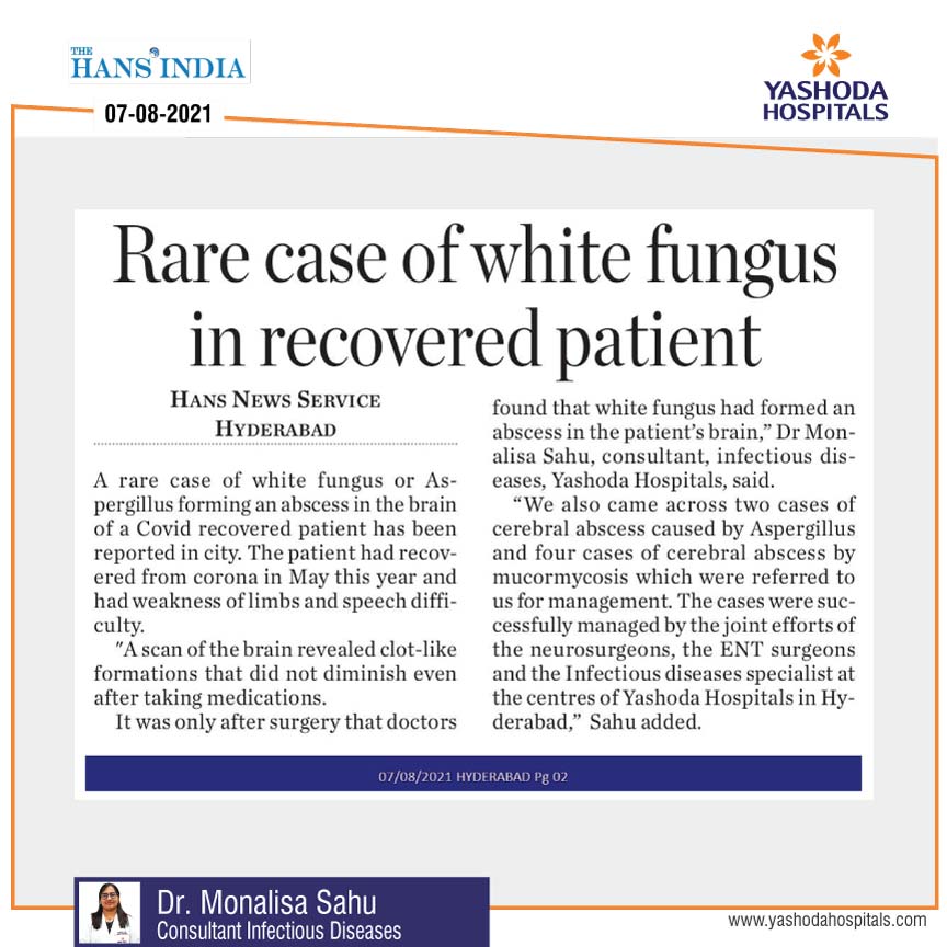 Rare case of white fungus in recovered patients