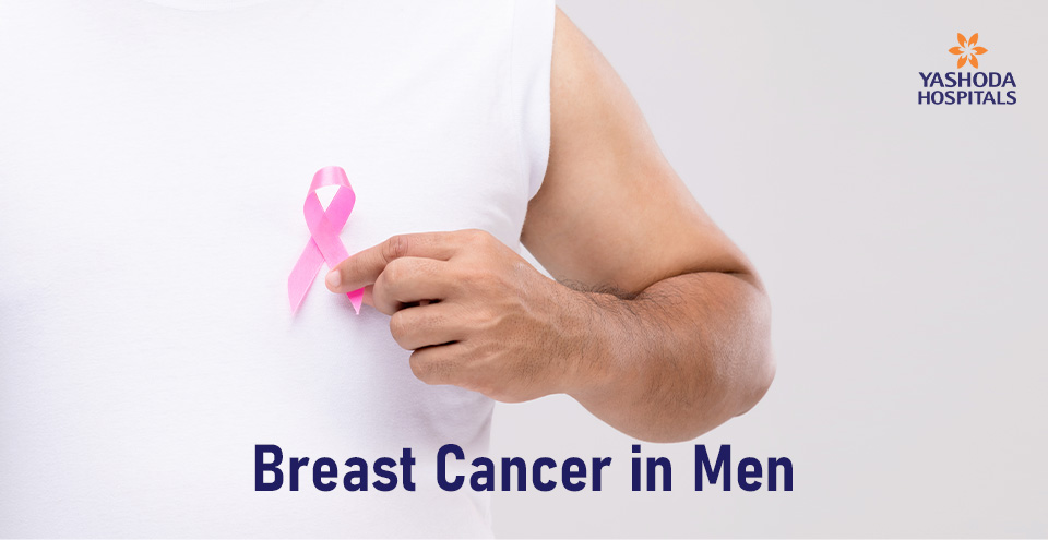 Breast Cancer in Men