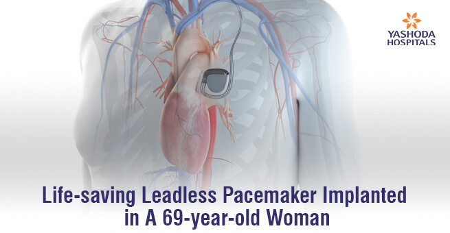 Life-saving Leadless Pacemaker Implanted in A 69-year-old Woman
