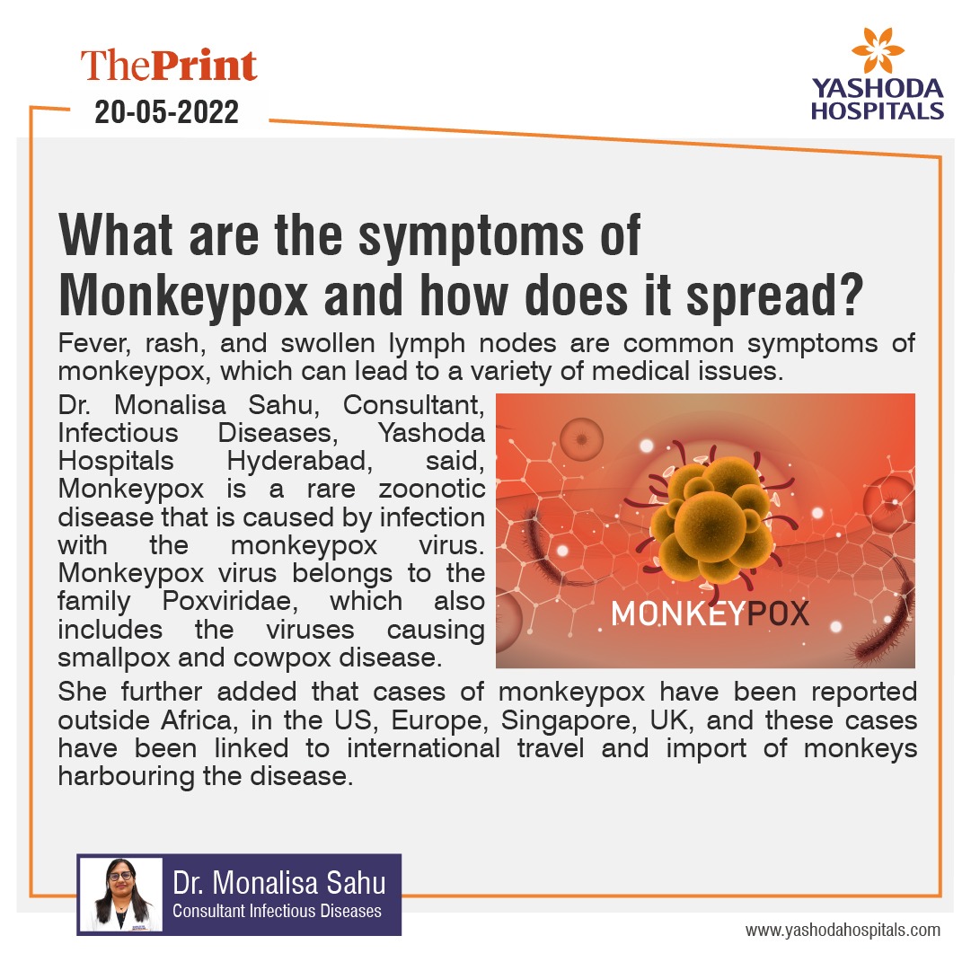 What are the symptoms of Monkeypox and how does it spread