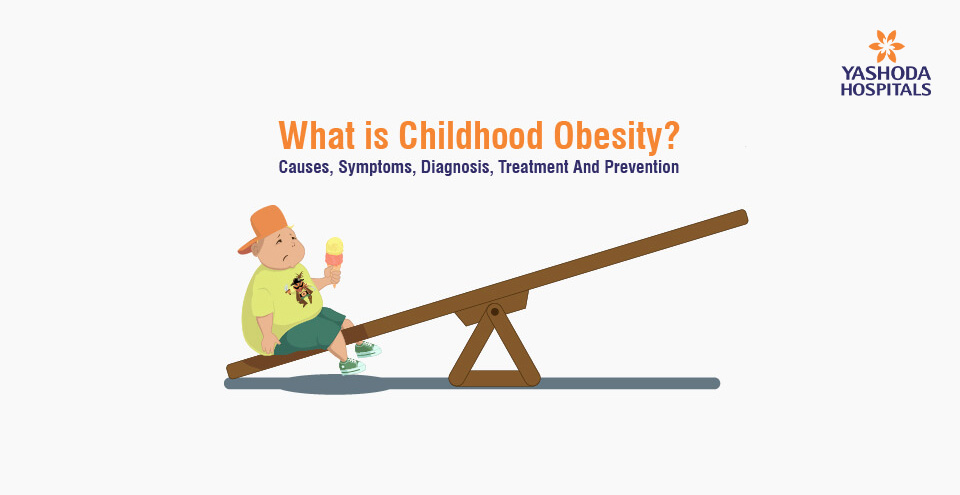 What is Childhood Obesity? Causes, Symptoms, Diagnosis, Treatment And Prevention