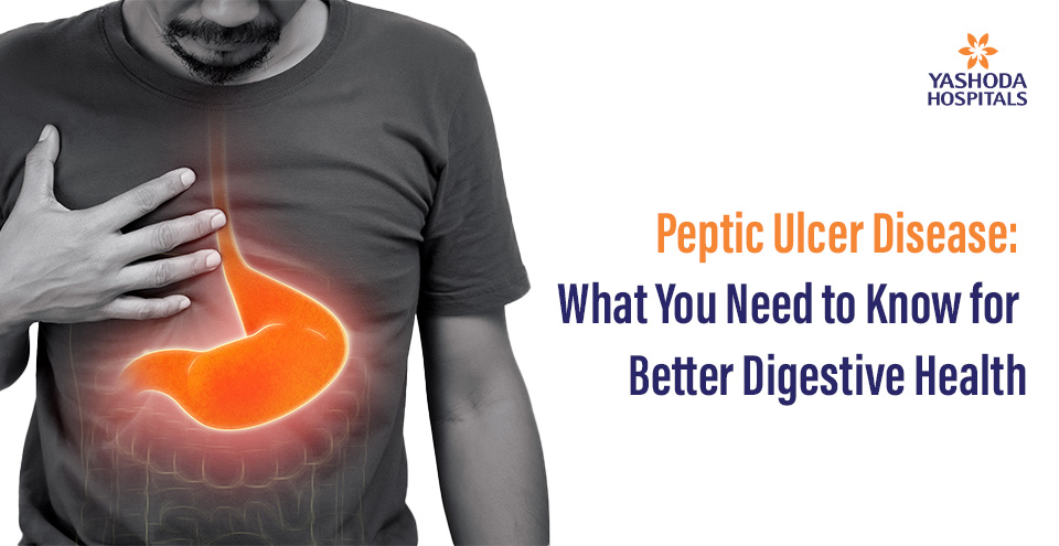 Peptic Ulcer Disease: What You Need to Know for Better Digestive Health