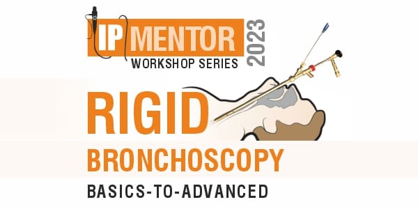 Rigid Bronchoscopy - Basics to Advanced