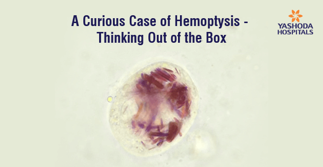 A Curious Case of Hemoptysis – Thinking Out of the Box