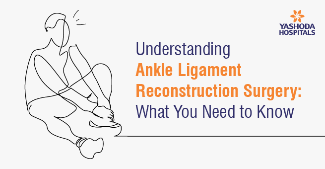 Understanding Ankle Ligament Reconstruction Surgery