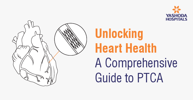 Unlocking Heart Health: A Comprehensive Guide to PTCA