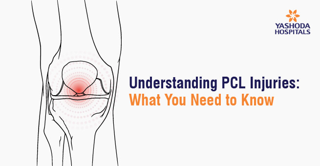 Understanding PCL Injuries: What You Need to Know