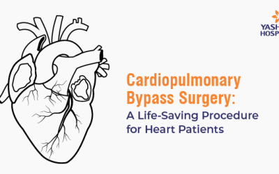 Cardiopulmonary Bypass Surgery: A Life-Saving Procedure for Heart Patients