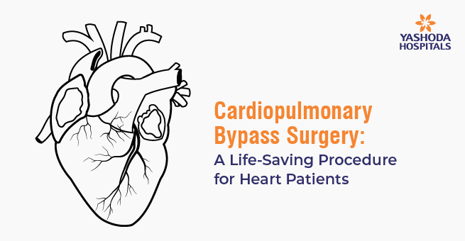Cardiopulmonary Bypass Surgery