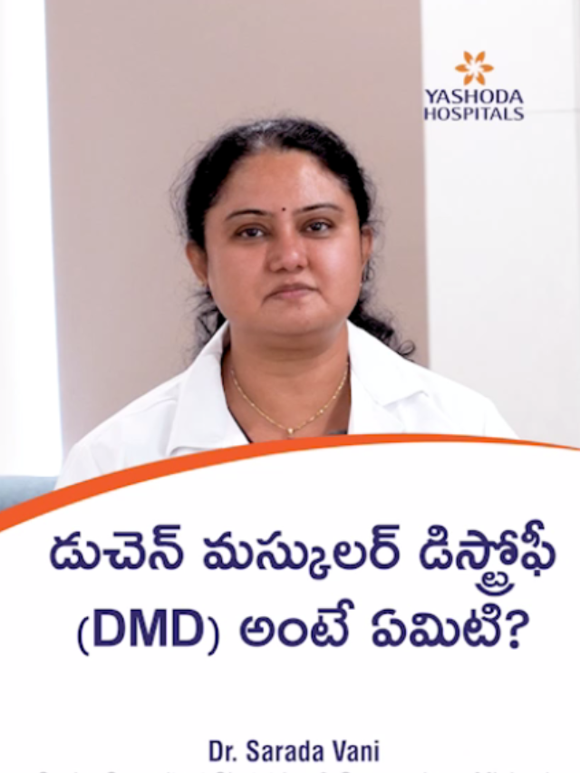 what is dmd post