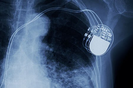 implantable heart devices 