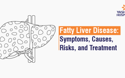 Fatty Liver Disease: Symptoms, Causes, Risks, and Treatment