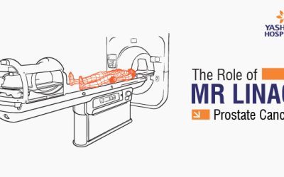 The Role of MR Linac in Prostate Cancer