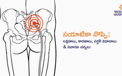 సయాటికా నొప్పి: లక్షణాలు, కారణాలు, సర్జరీ విధానాలు & నివారణ చర్యలు