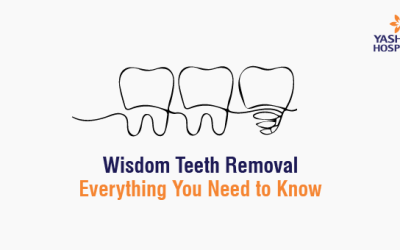 Wisdom Teeth Removal: Everything You Need to Know