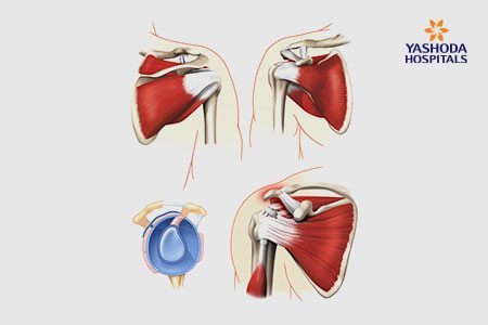 Biceps Tendon