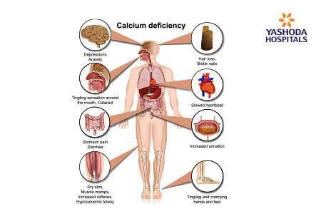 symptoms of Calcium metabolism